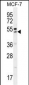 QTRTD1 Antibody (C-term)